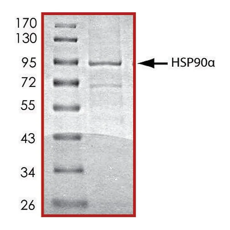 Merck HSP90 alpha, His tagged human