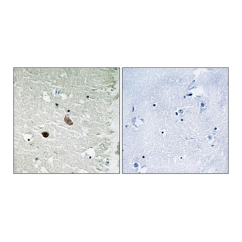 Merck Anti-CAMK2 antibody produced in rabbit