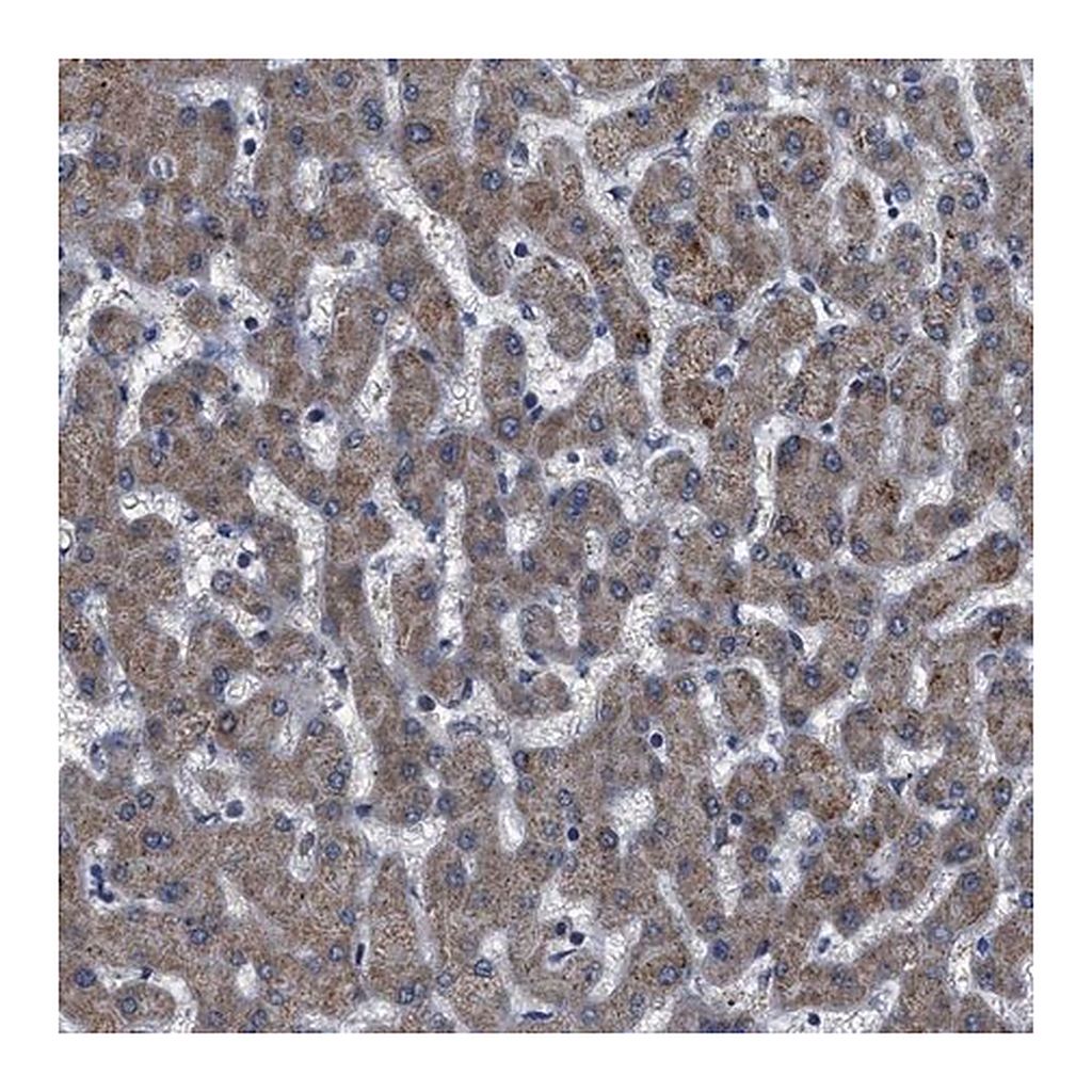 Merck Anti-DDX56 antibody produced in rabbit