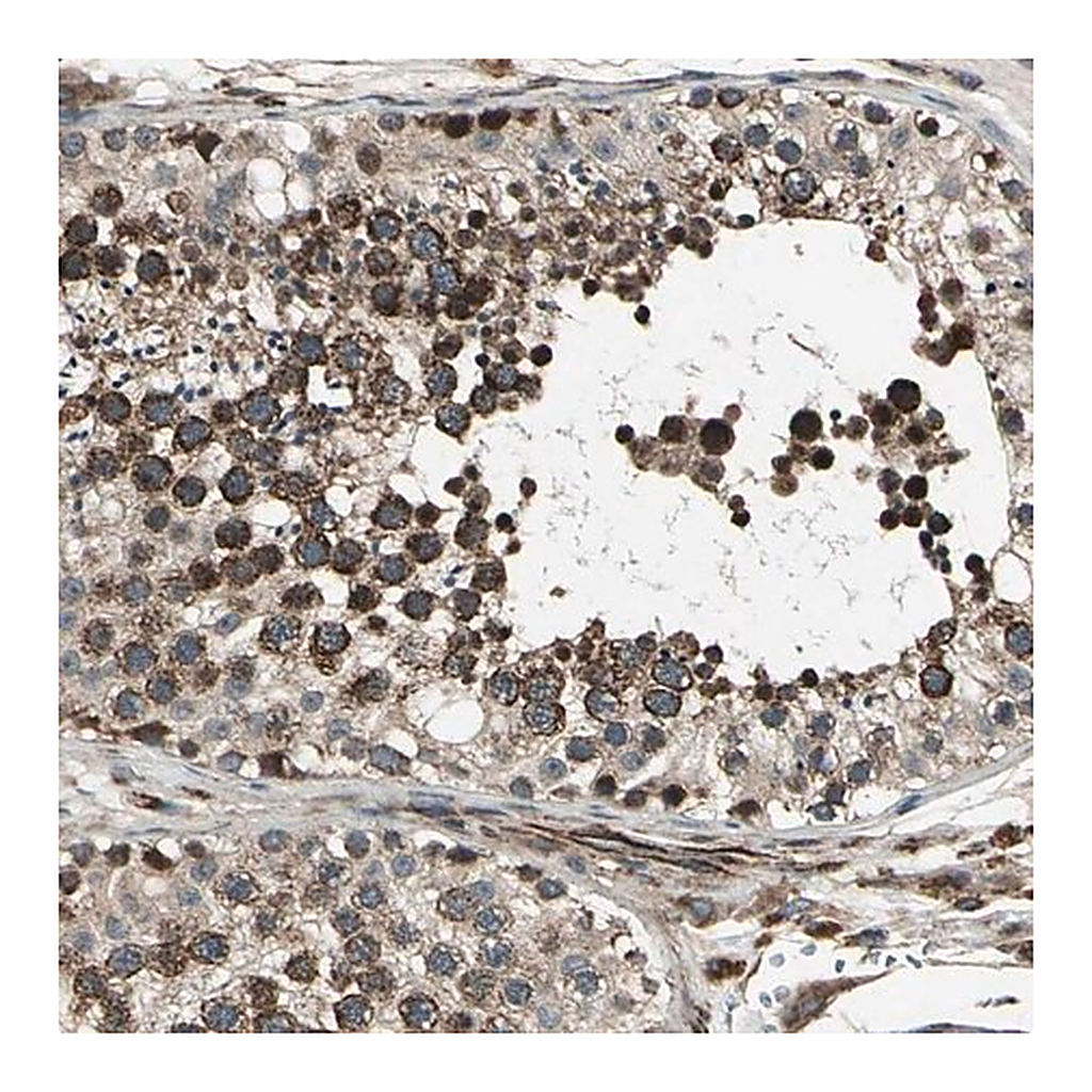 Merck ANTI-EXD2 antibody produced in rabbit