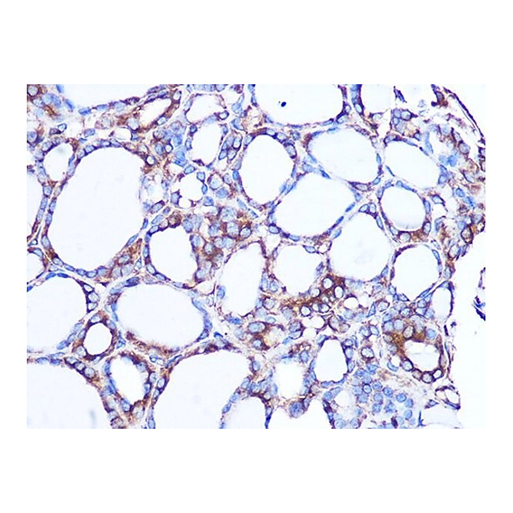 Merck Anti-LOXL2 antibody produced in rabbit