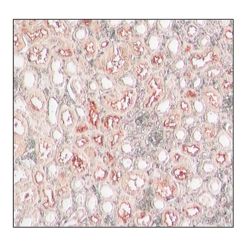 Merck Anti-ACE2 (C-terminal) antibody produced in rabbit