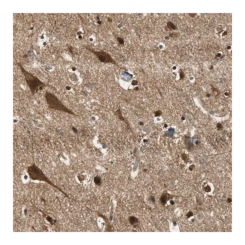 Merck Anti-UBQLN2 antibody produced in rabbit