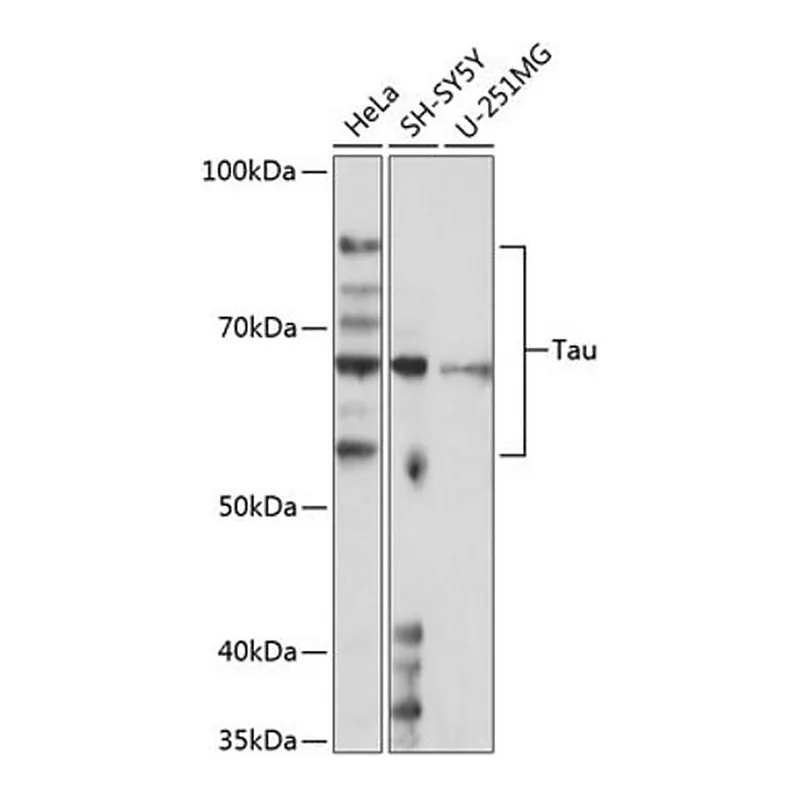 Merck Anti-Tau antibody produced in rabbit