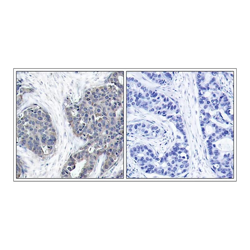 Merck Anti-STMN1 (Ab-38) antibody produced in rabbit