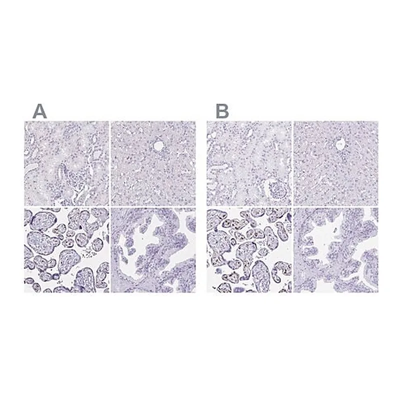 Merck Anti-LIN28B antibody produced in rabbit