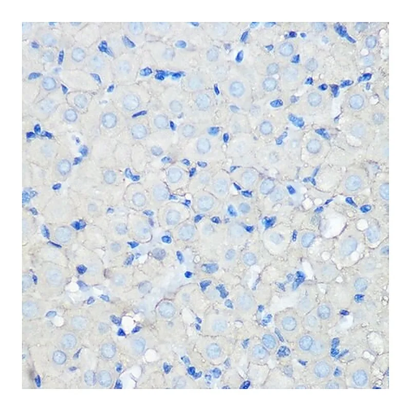 Merck Anti-SR-BI antibody produced in rabbit