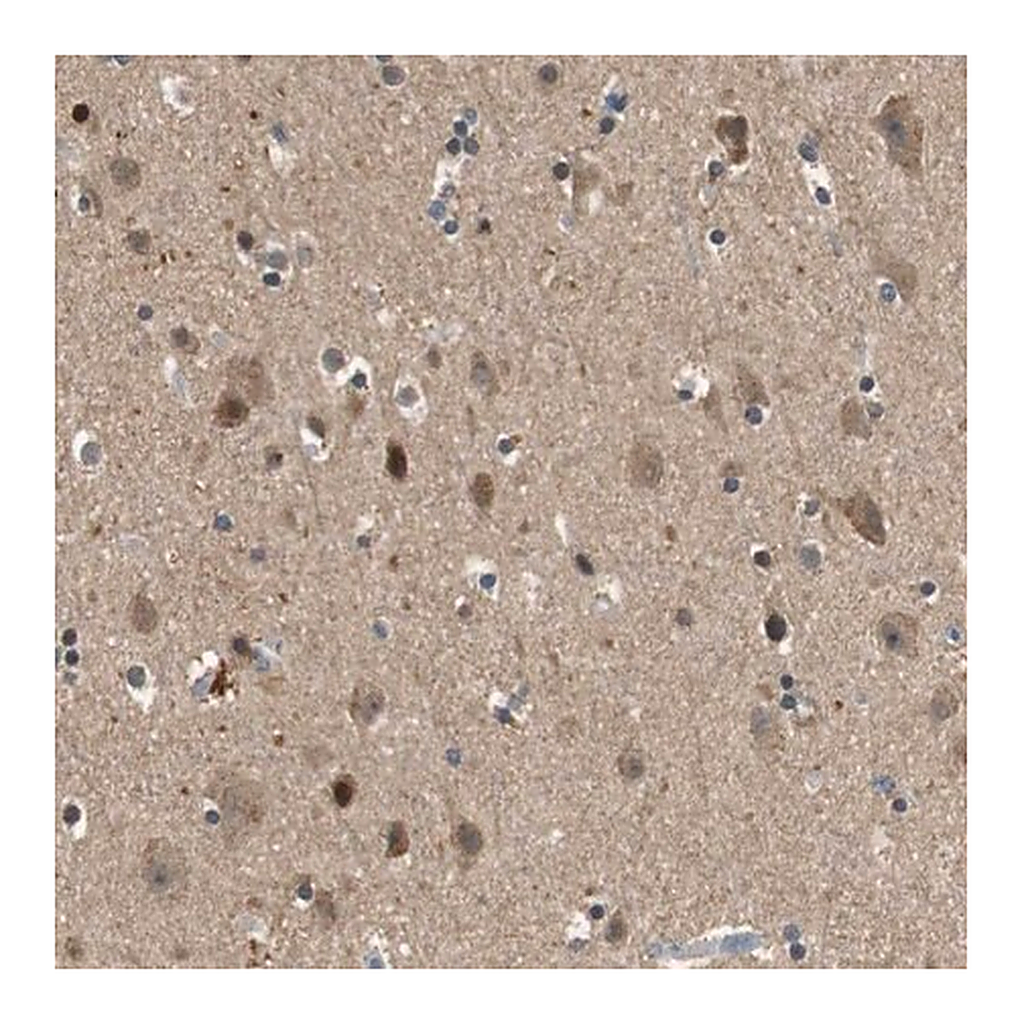 Merck Anti-HSPA13 antibody produced in rabbit