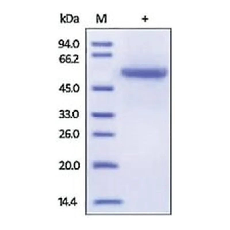 Merck CARBONIC ANHYDRASE 9/CA9,HUMAN