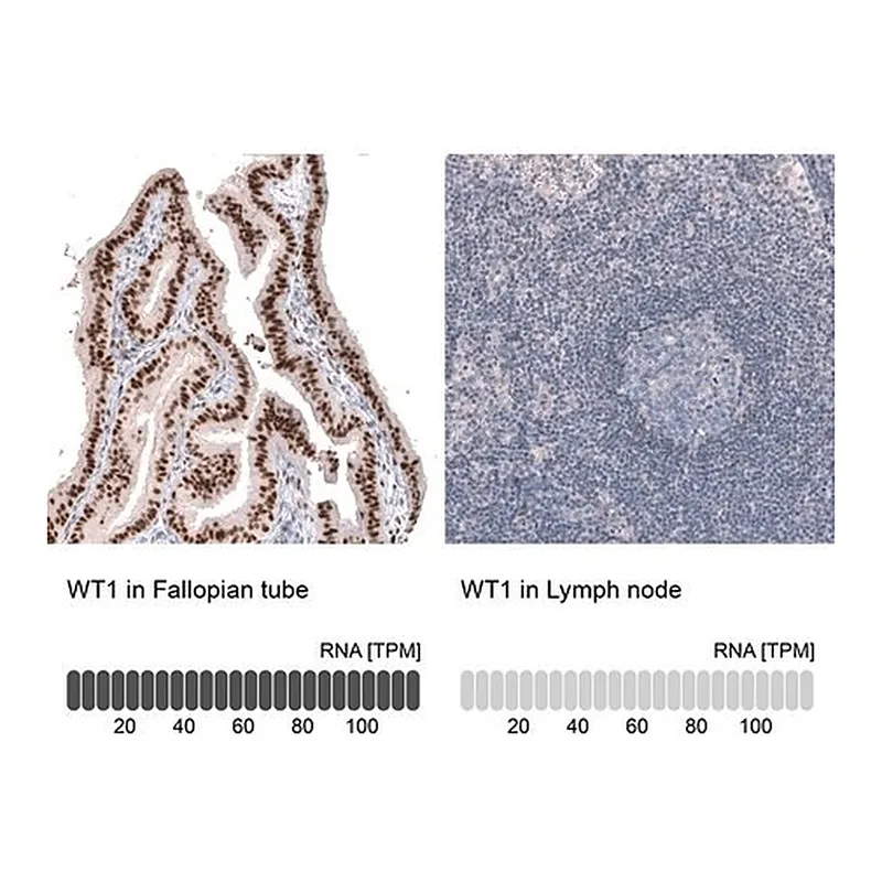 Merck Anti-WT1 antibody produced in mouse