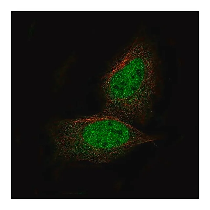 Merck Monoclonal Anti-PRAME antibody produced in mouse