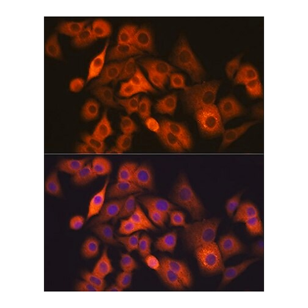 Merck Anti-ALDH1A1 antibody produced in rabbit