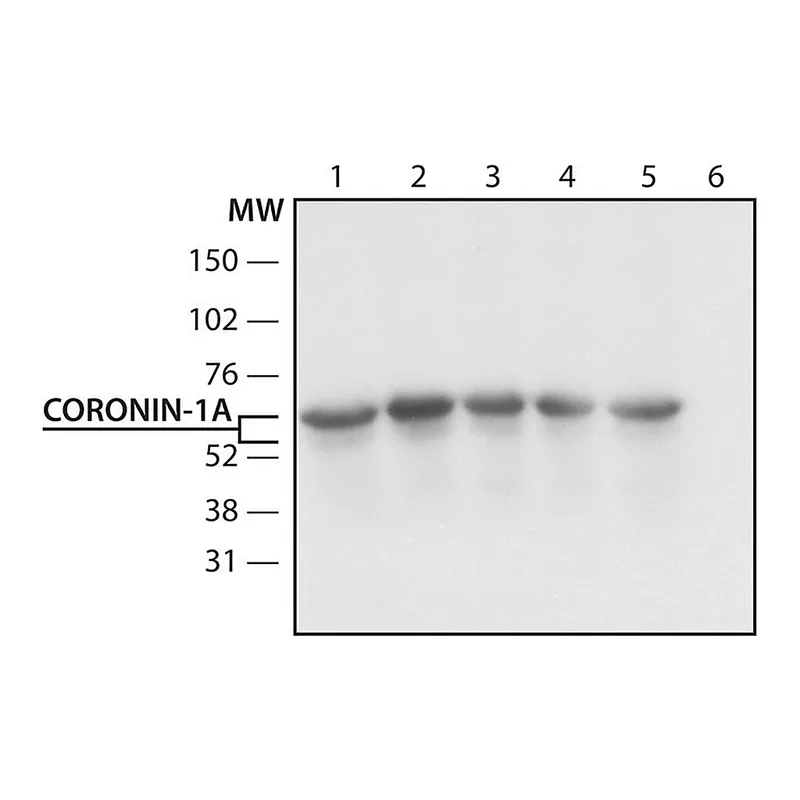 Merck Anti-Coronin-1A (N-terminal) antibody produced in rabbit