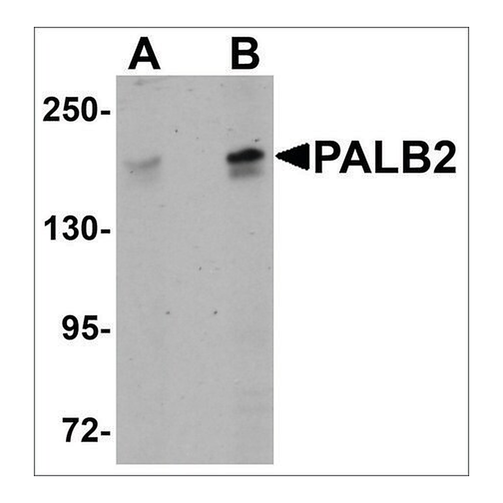 Merck Anti-PALB2 antibody produced in rabbit