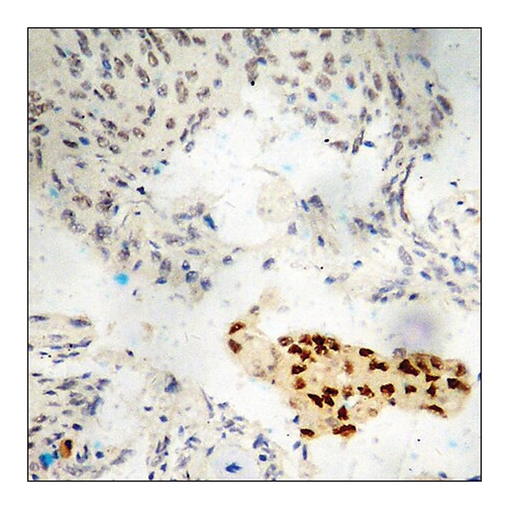 Merck Anti-phospho-Estrogen Receptor-alpha (pSer118) antibody produced in rabbit