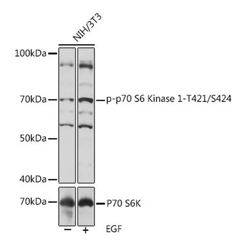 Merck Anti-Phospho-p70 S6 Kinase 1-T421/S424 antibody produced in rabbit