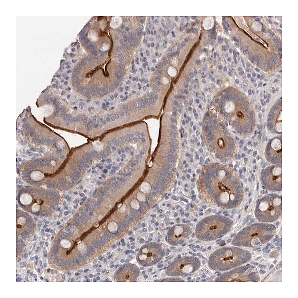 Merck Anti-USH1C antibody produced in rabbit