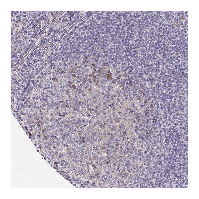 Atlas Antibodies Anti-LTK Antibody