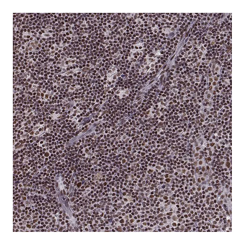 Atlas Antibodies Anti-LUC7L Antibody