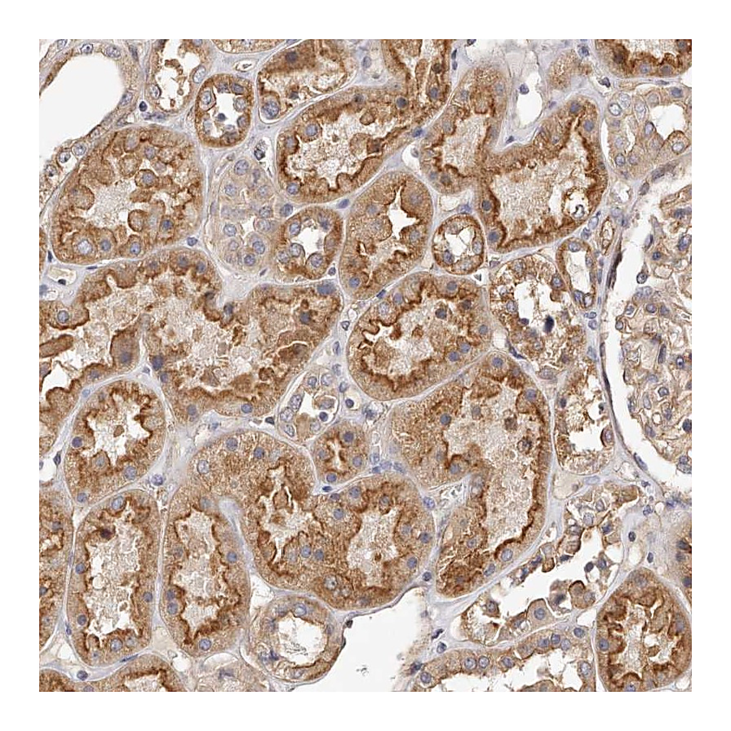Atlas Antibodies Anti-LTV1 Antibody