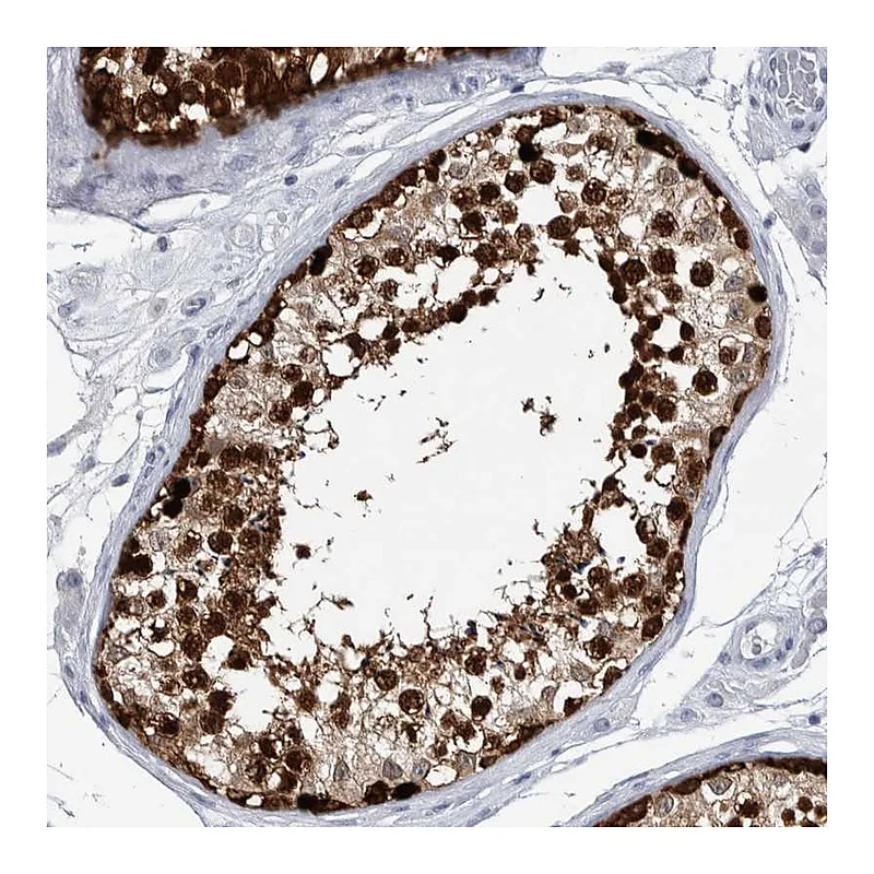 Atlas Antibodies Anti-LURAP1L Antibody