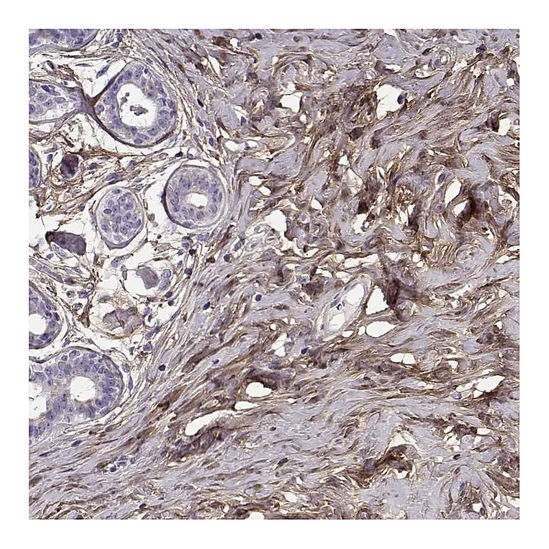 Atlas Antibodies Anti-LUM Antibody