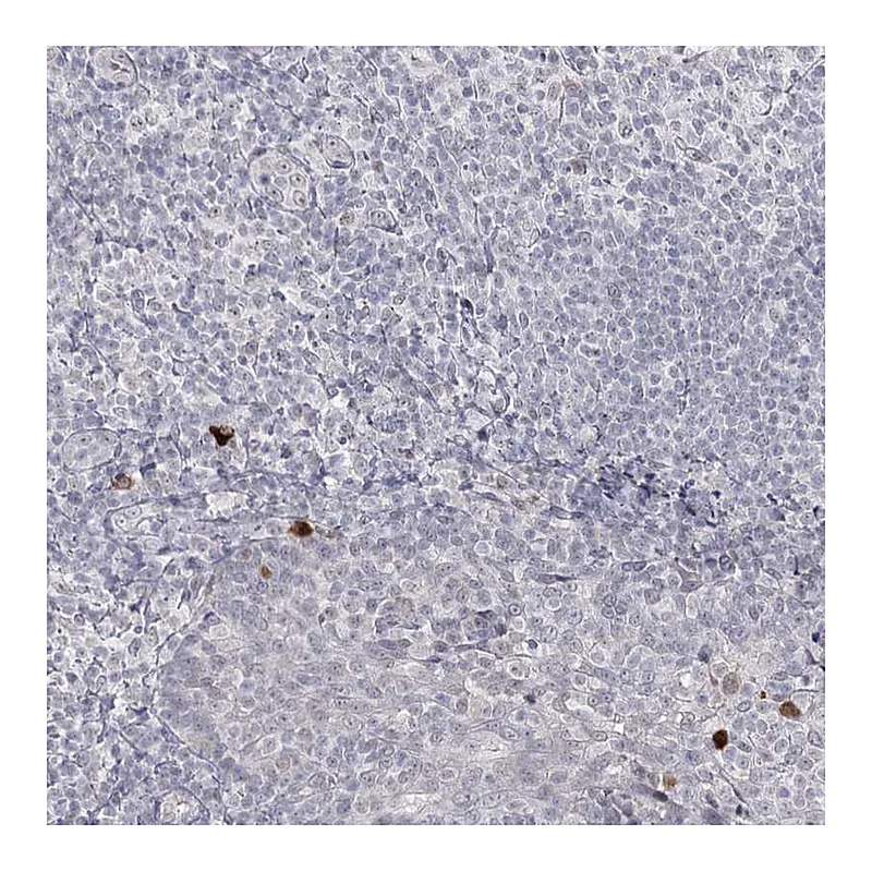 Atlas Antibodies Anti-LY6G5C Antibody