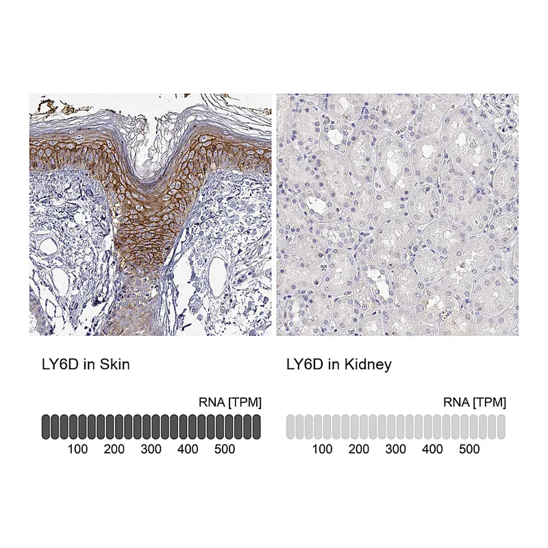 Atlas Antibodies Anti-LY6D Antibody