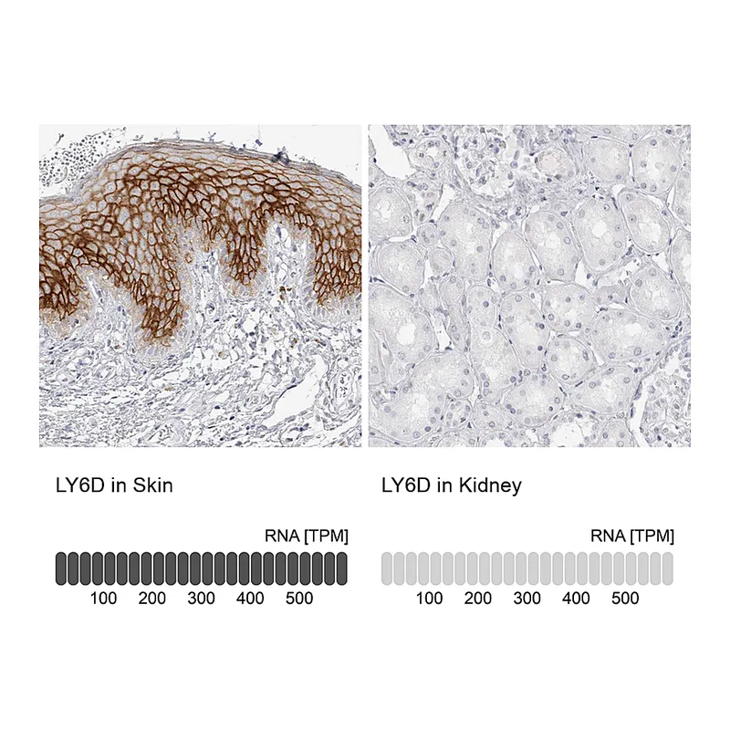 Atlas Antibodies Anti-LY6D Antibody