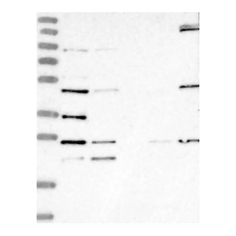 Atlas Antibodies Anti-LYAR Antibody