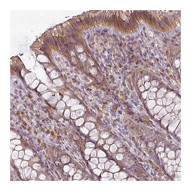 Atlas Antibodies Anti-LY75 Antibody