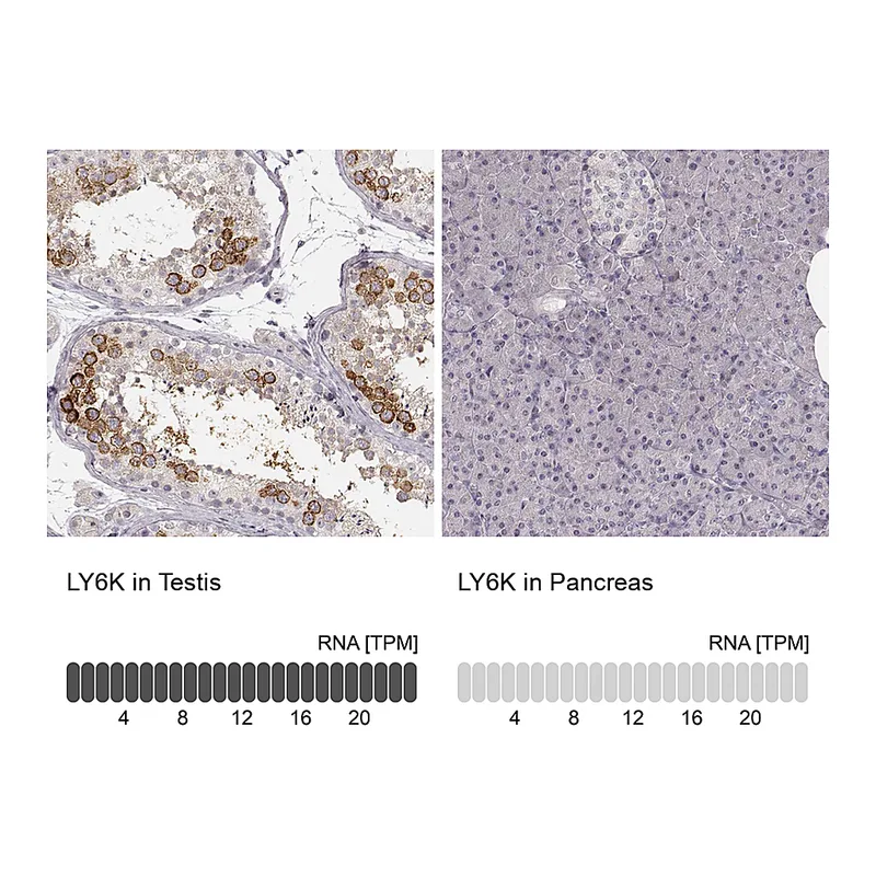 Atlas Antibodies Anti-LY6K Antibody