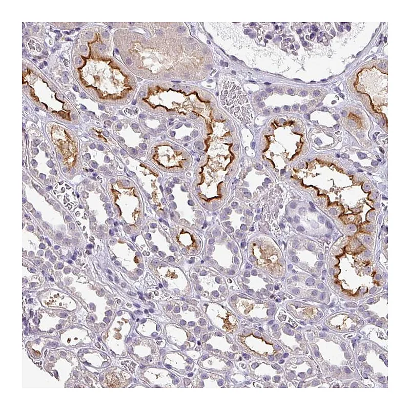 Atlas Antibodies Anti-LY9 Antibody
