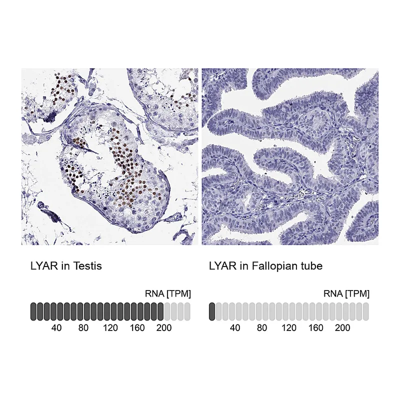 Atlas Antibodies Anti-LYAR Antibody