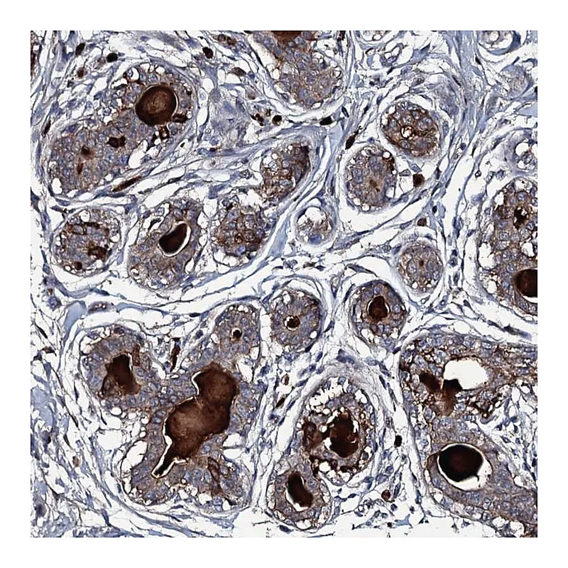 Atlas Antibodies Anti-LYG2 Antibody