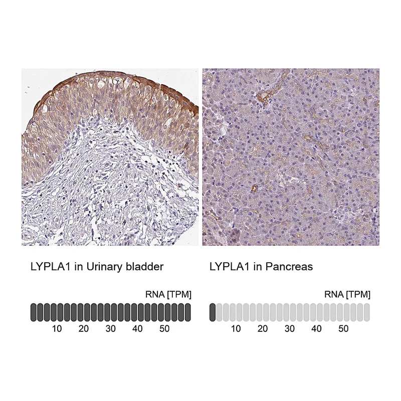 Atlas Antibodies Anti-LYPLA1 Antibody