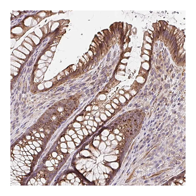 Atlas Antibodies Anti-LYPD5 Antibody