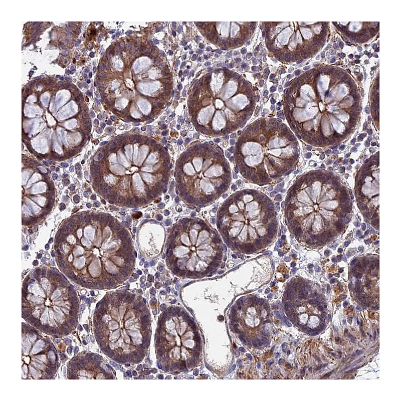 Atlas Antibodies Anti-LYPD5 Antibody