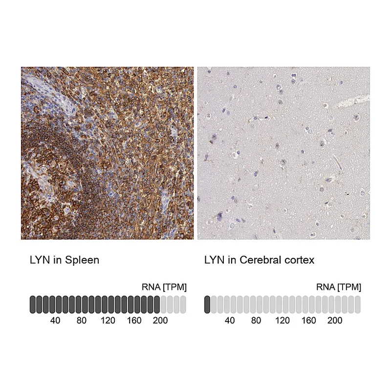 Atlas Antibodies Anti-LYN Antibody