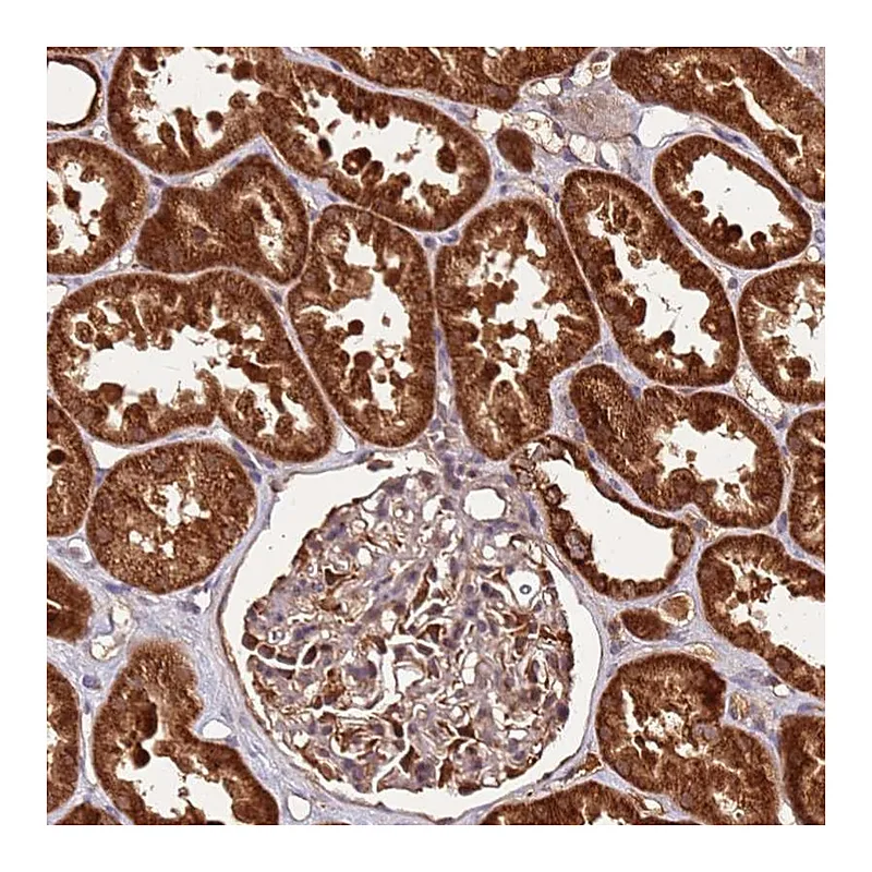 Atlas Antibodies Anti-LYPLAL1 Antibody