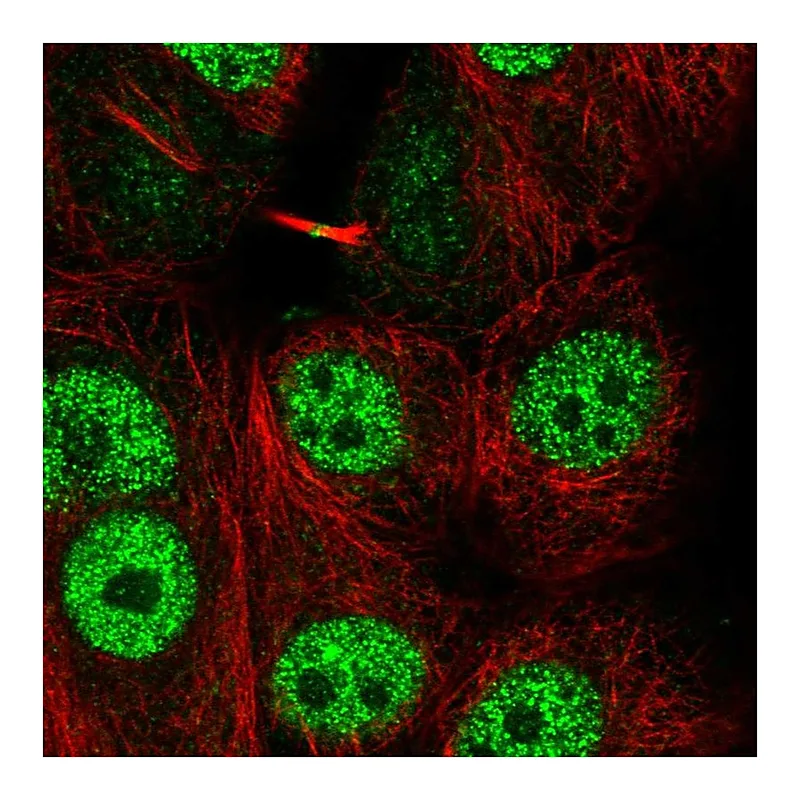 Atlas Antibodies Anti-LYRM1 Antibody