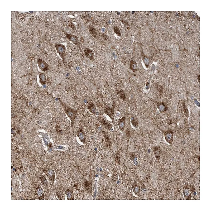 Atlas Antibodies Anti-LYRM4 Antibody