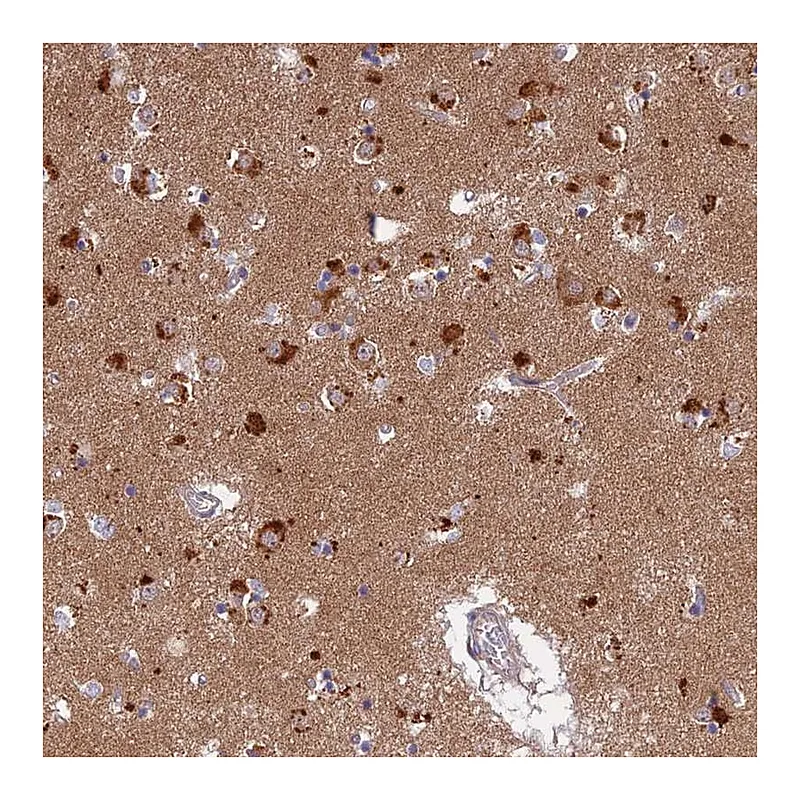 Atlas Antibodies Anti-LYSMD2 Antibody