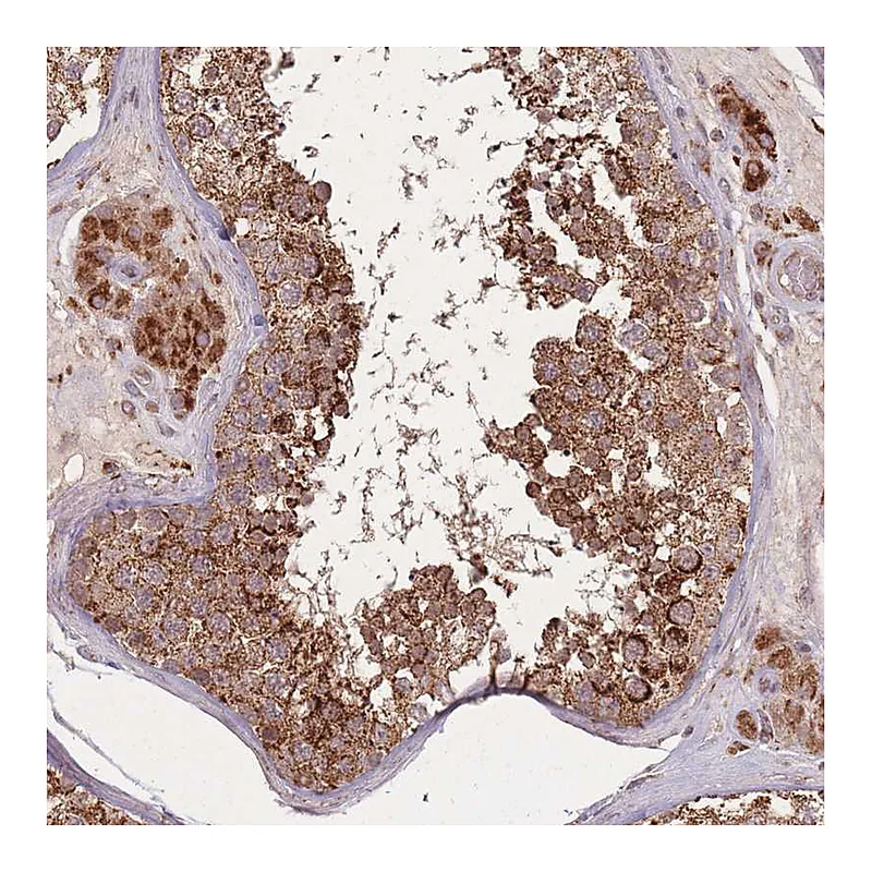 Atlas Antibodies Anti-LYRM7 Antibody
