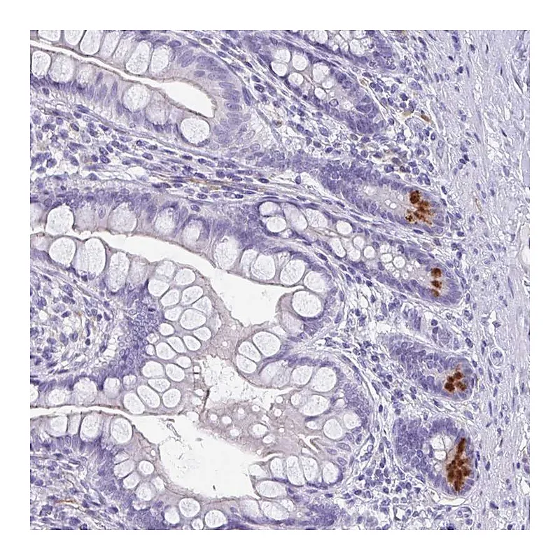 Atlas Antibodies Anti-LYRM2 Antibody