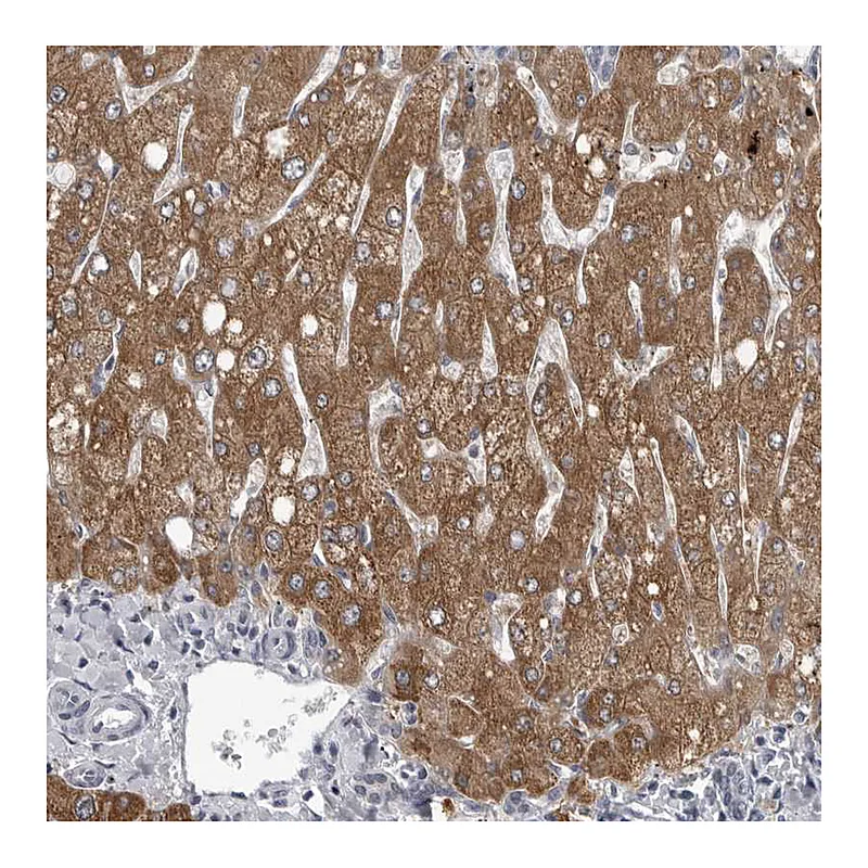 Atlas Antibodies Anti-LYSMD1 Antibody