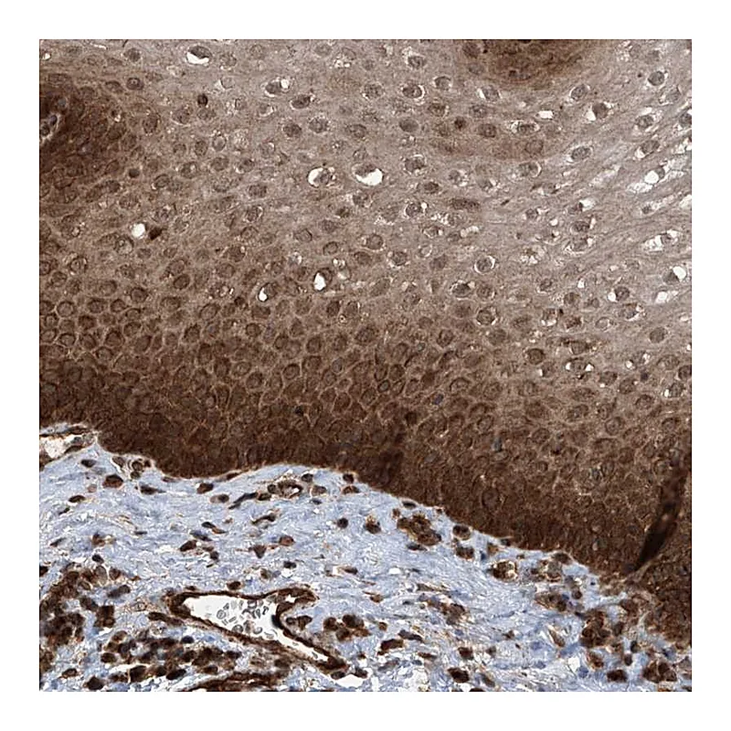 Atlas Antibodies Anti-LYSMD4 Antibody