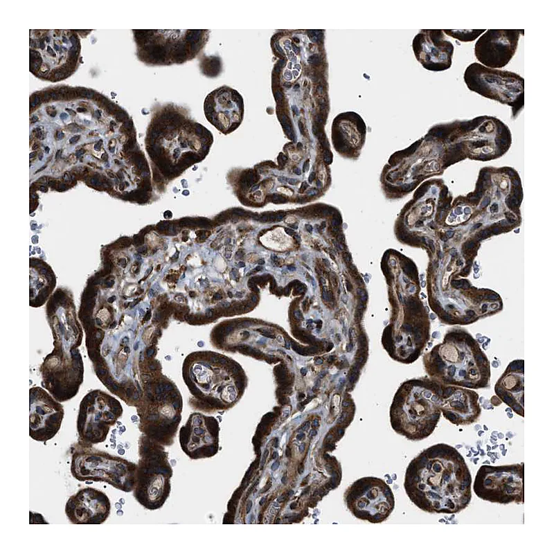 Atlas Antibodies Anti-LYSMD3 Antibody