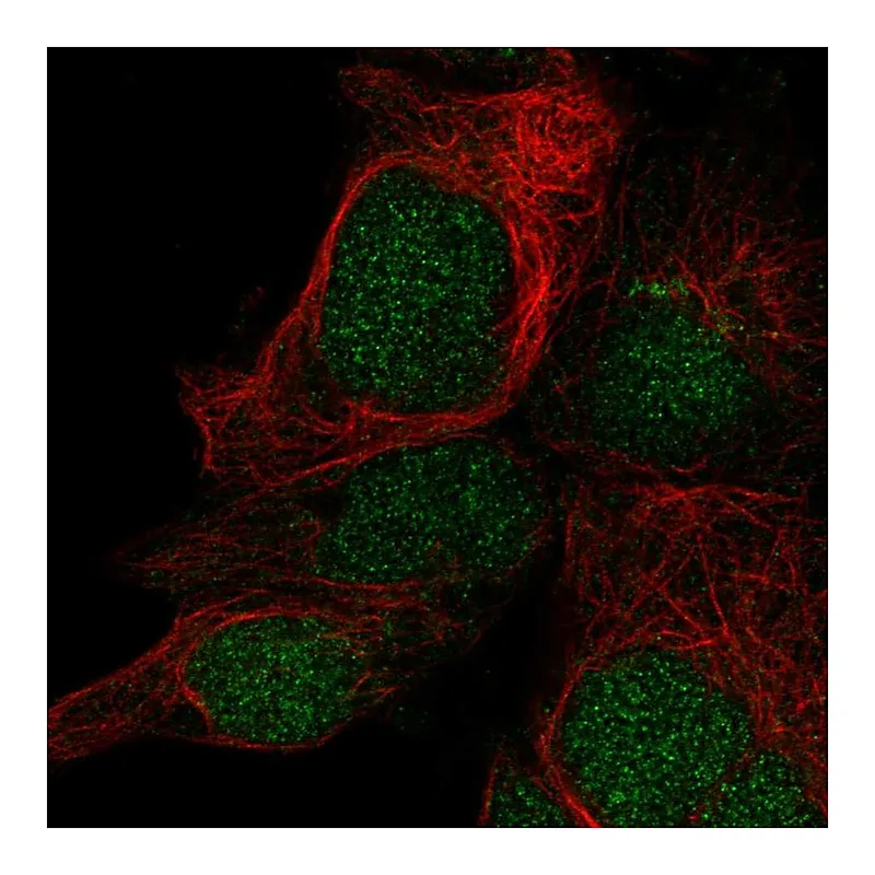 Atlas Antibodies Anti-LYSMD1 Antibody