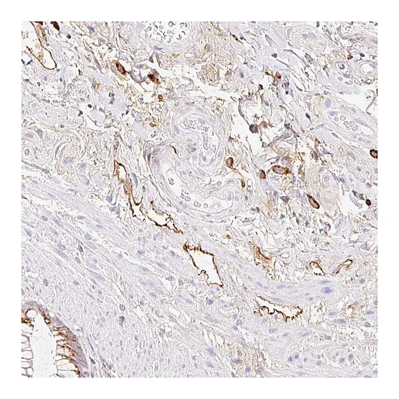 Atlas Antibodies Anti-LYVE1 Antibody